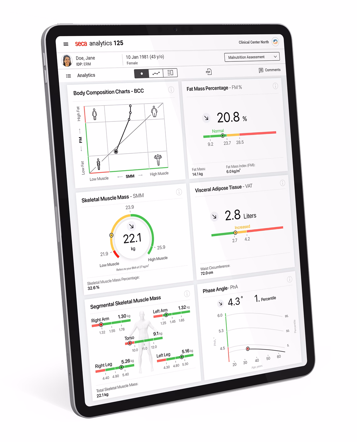seca analytics software on an iPad showing a body composition report with charts and metrics